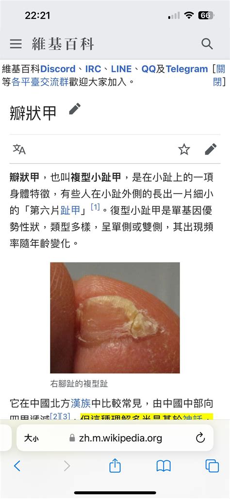 漢人 腳指甲|漢人特徵？腳「小拇指」兩瓣！生物師破謠：跟直髮一樣是顯性基。